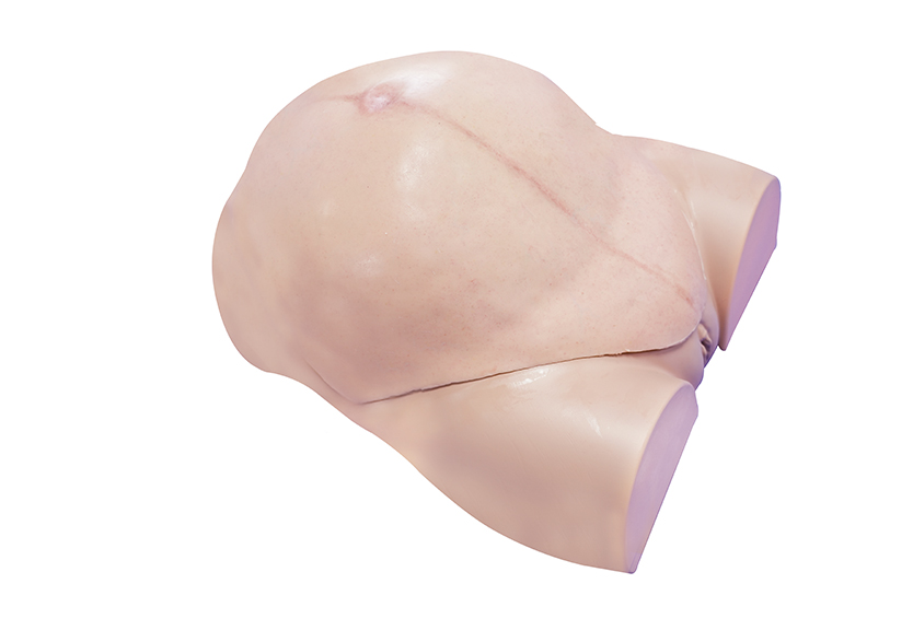 穿戴式剖宮産手術訓練模型